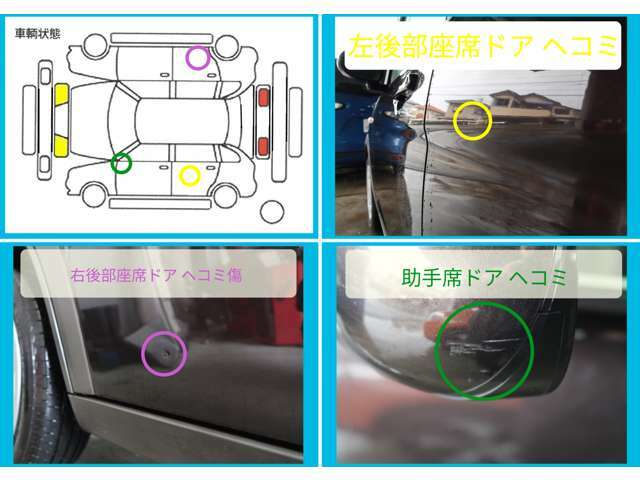 気になる傷のご紹介です！！