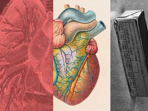 “悪玉”LDLコレステロールとは何か？ 数値を下げるために今すぐできる方法を医学博士が解説